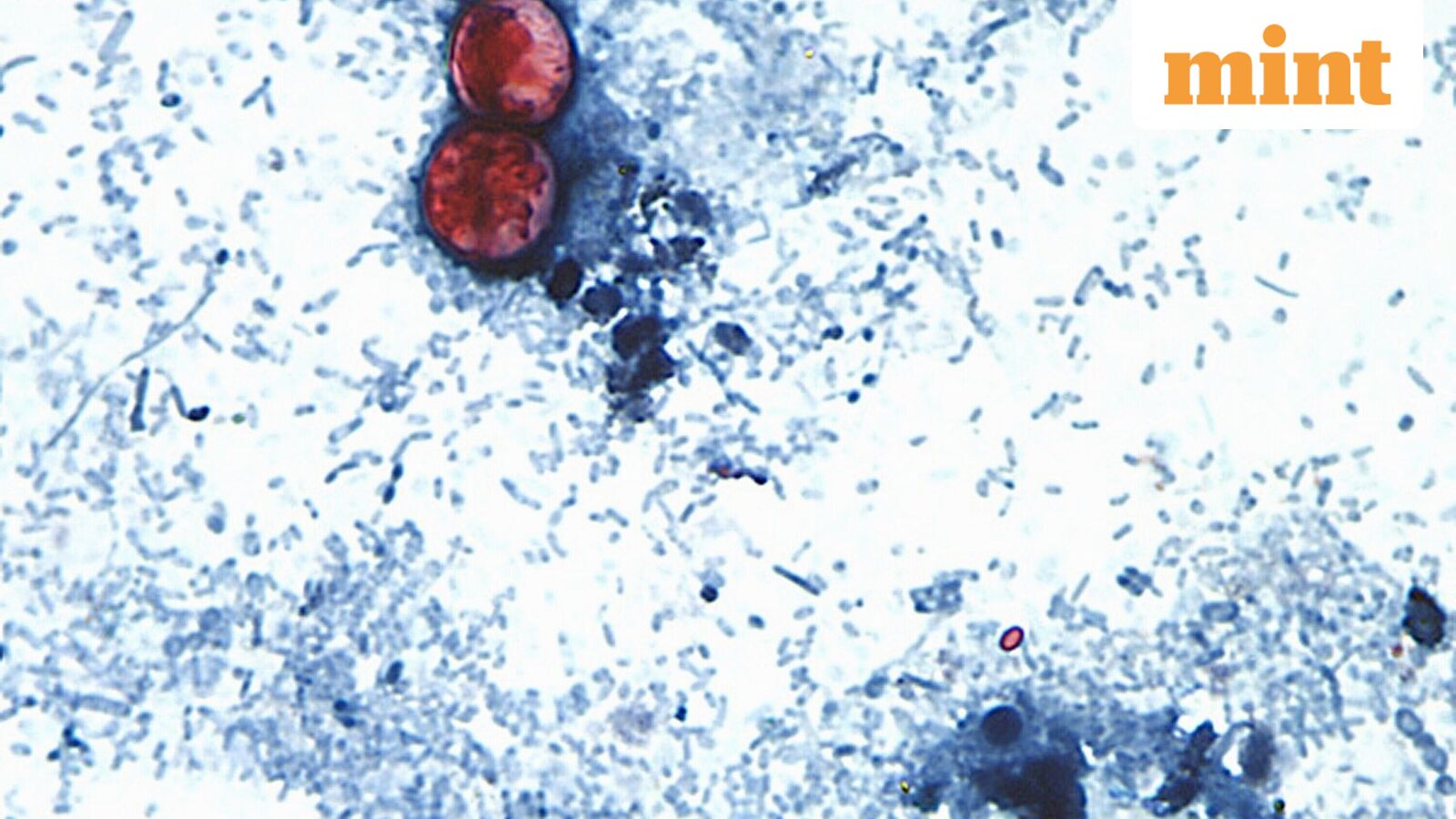 Michigan confirms first Cyclospora deaths in US amid outbreak that has sickened over 20,000