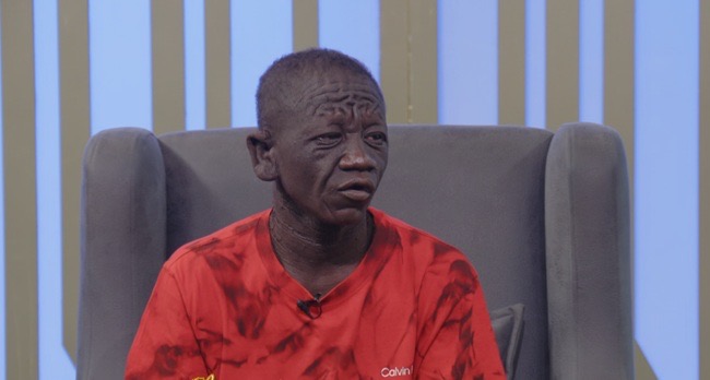 Tanor Hayford recounts how his appearance denied him education