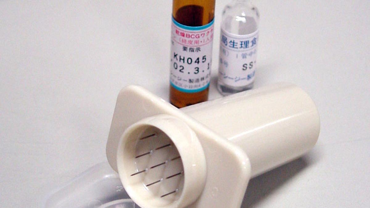 TB vaccine offers clue to retrain immune system against Alzheimer’s