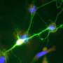 High-speed microscopy reveals electrical activity across the brain