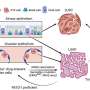 Lung cancers can use two different mechanisms to evade KRAS-inhibiting drugs