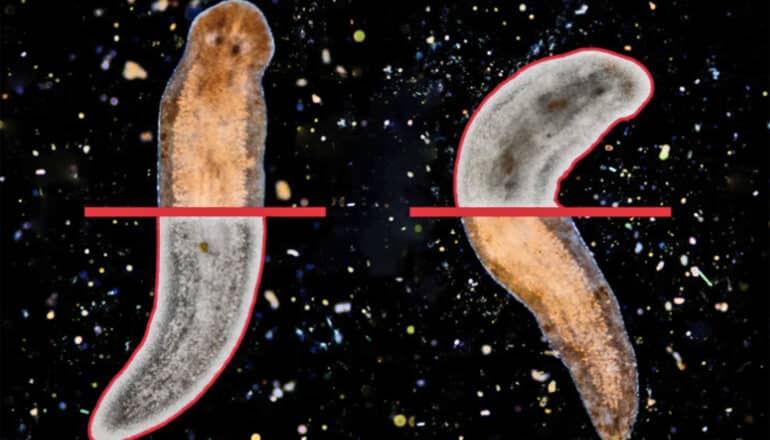 Could humans ever regenerate their brains like these worms?