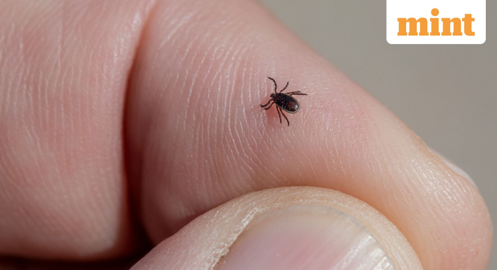 What is tularemia or rabbit fever? Symptoms, spread and treatment explained as New York reports three possible cases