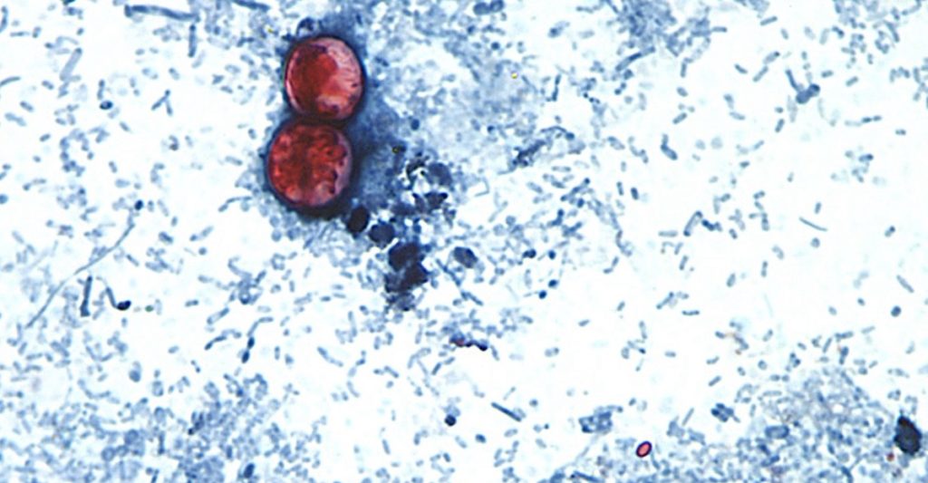 Cyclospora spreads through human waste — so how did it get on food?