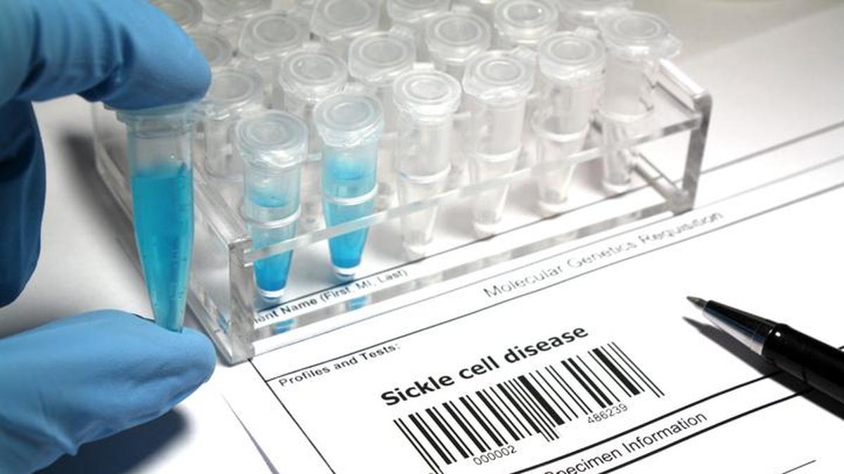 CSIR-CCMB develops India-specific tool to predict Sickle Cell severity