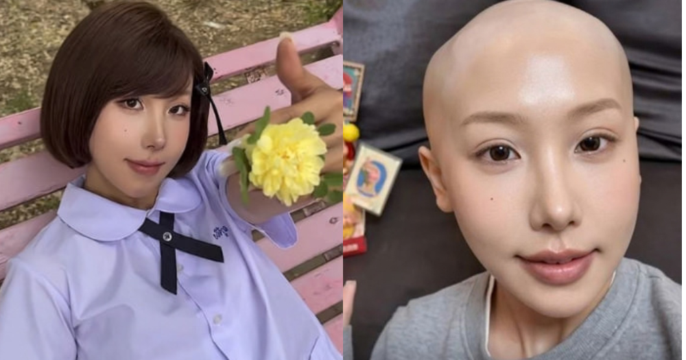 Chinese blogger, 25, dies of stomach cancer, drank 5 cups of coffee & milk tea a day without water, warns readers not to follow her unhealthy habits