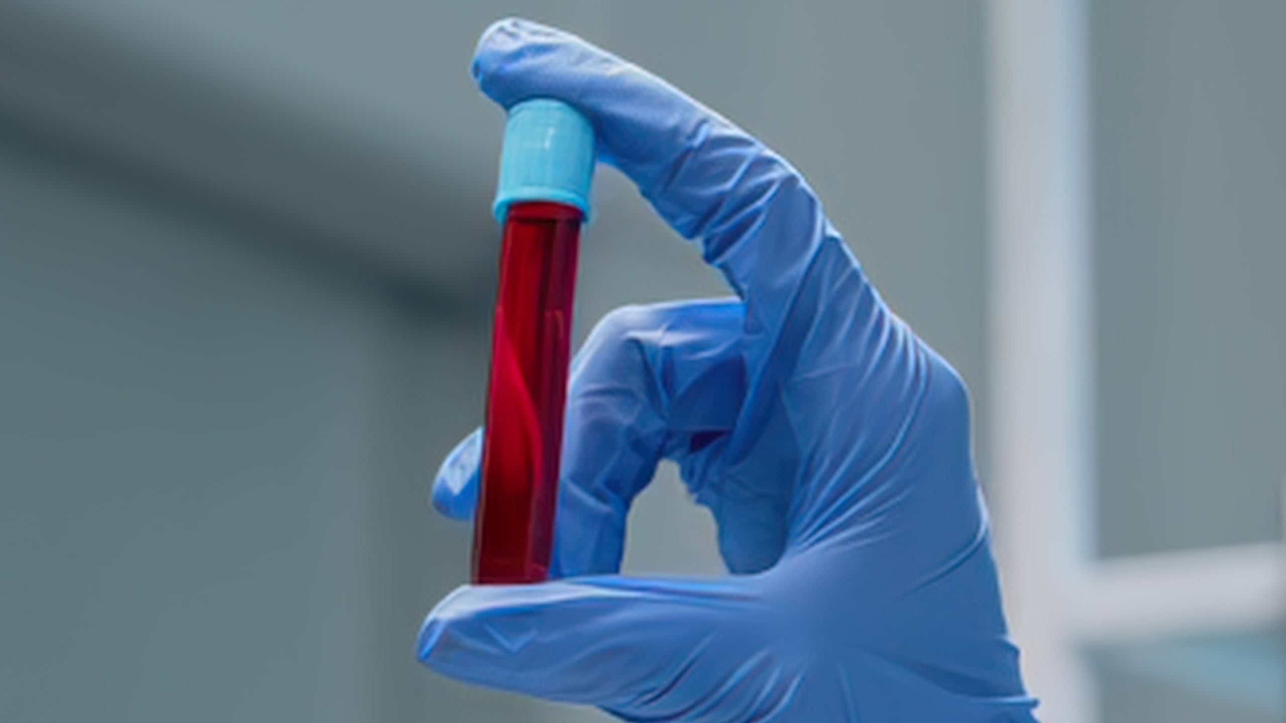 We May Have Been Wrong About Fasting Before Blood Tests, Study Reveals