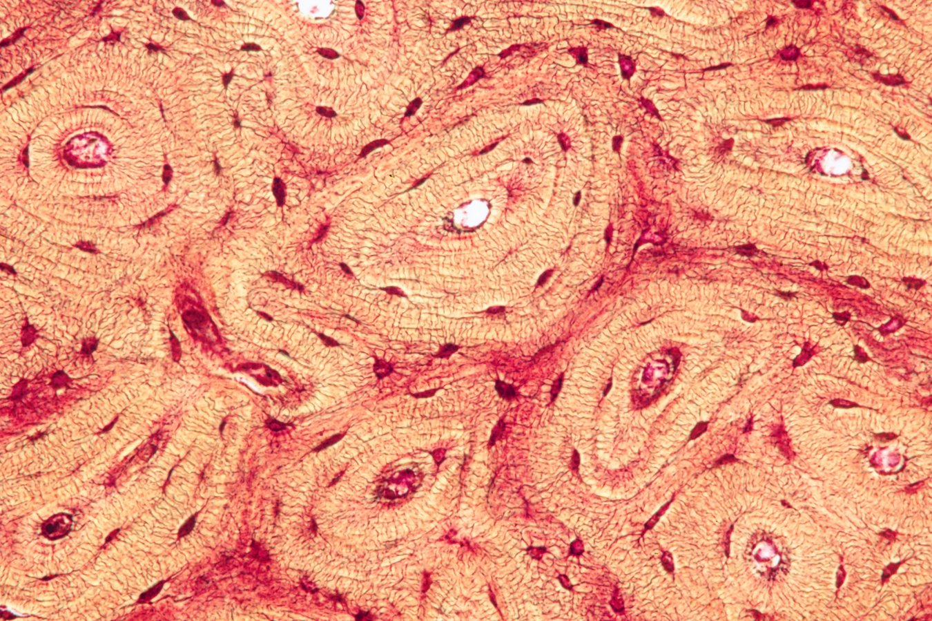 Compressing bones releases molecules that ease traumatic brain injuries