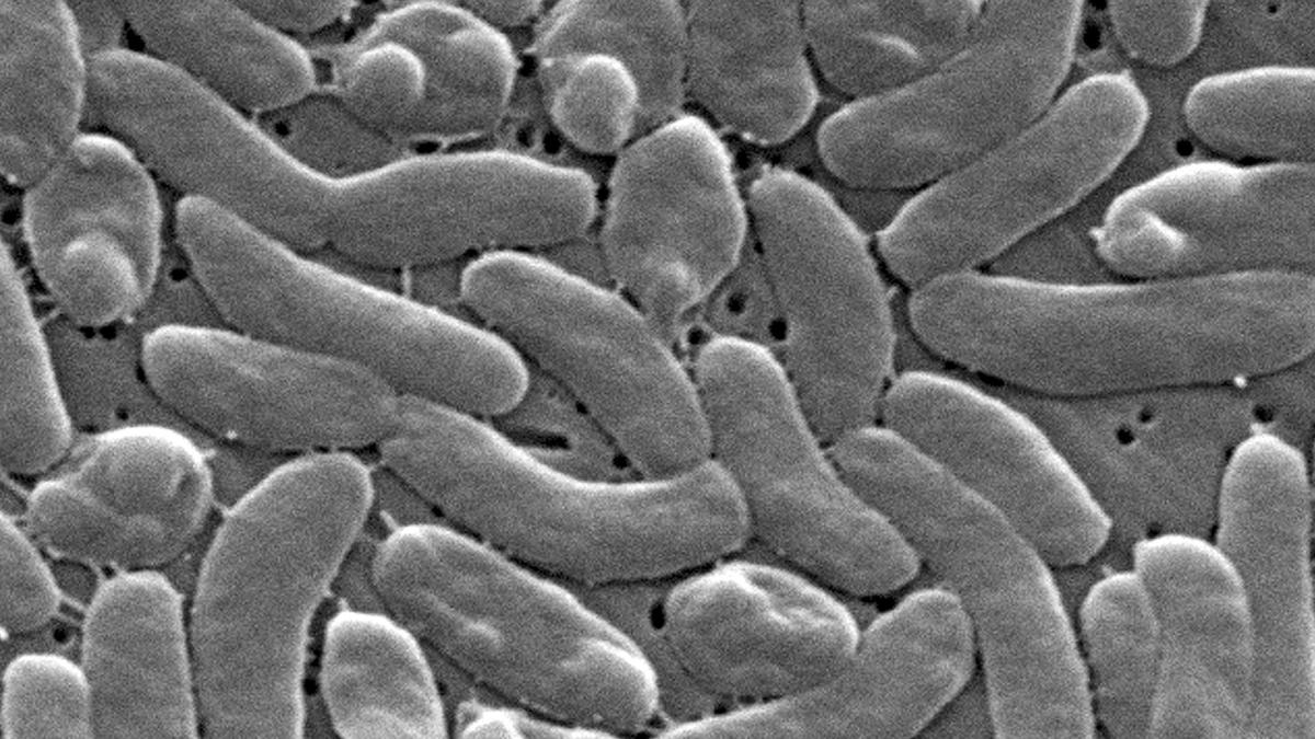Flesh-eating bacteria are devouring limbs in warming waters worldwide − here’s how to protect yourself