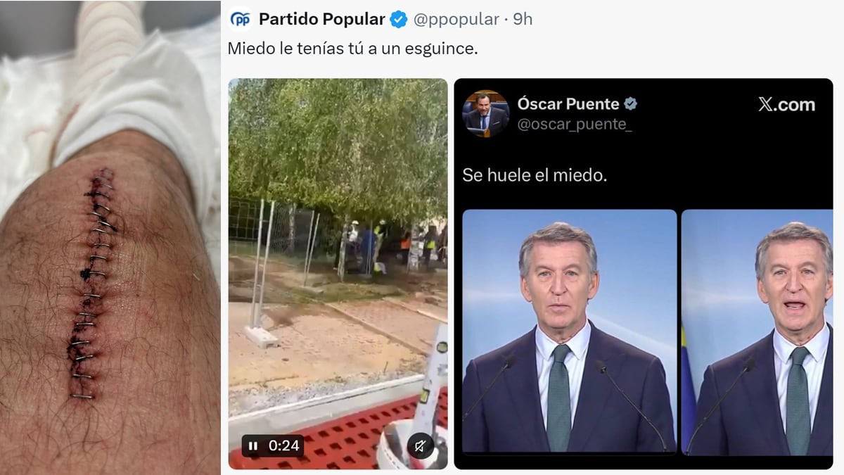 El PP inicia la precampaña con un vídeo en el que se burla de una lesión de Óscar Puente: “Miedo, tu esguince”