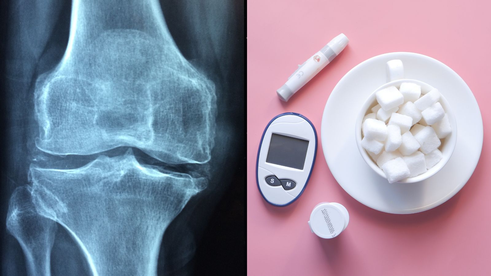 The bone–blood sugar connection: What osteocalcin has to do with glucose control