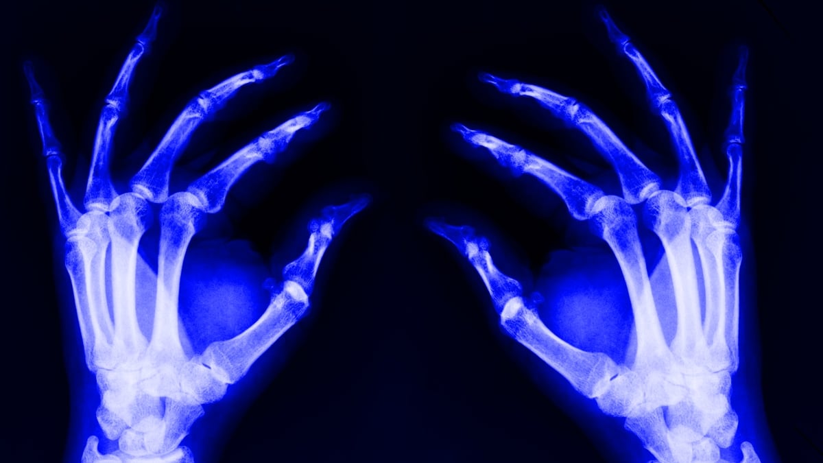 A Hidden Cause of Aging May Spread From Deep Inside Your Bones