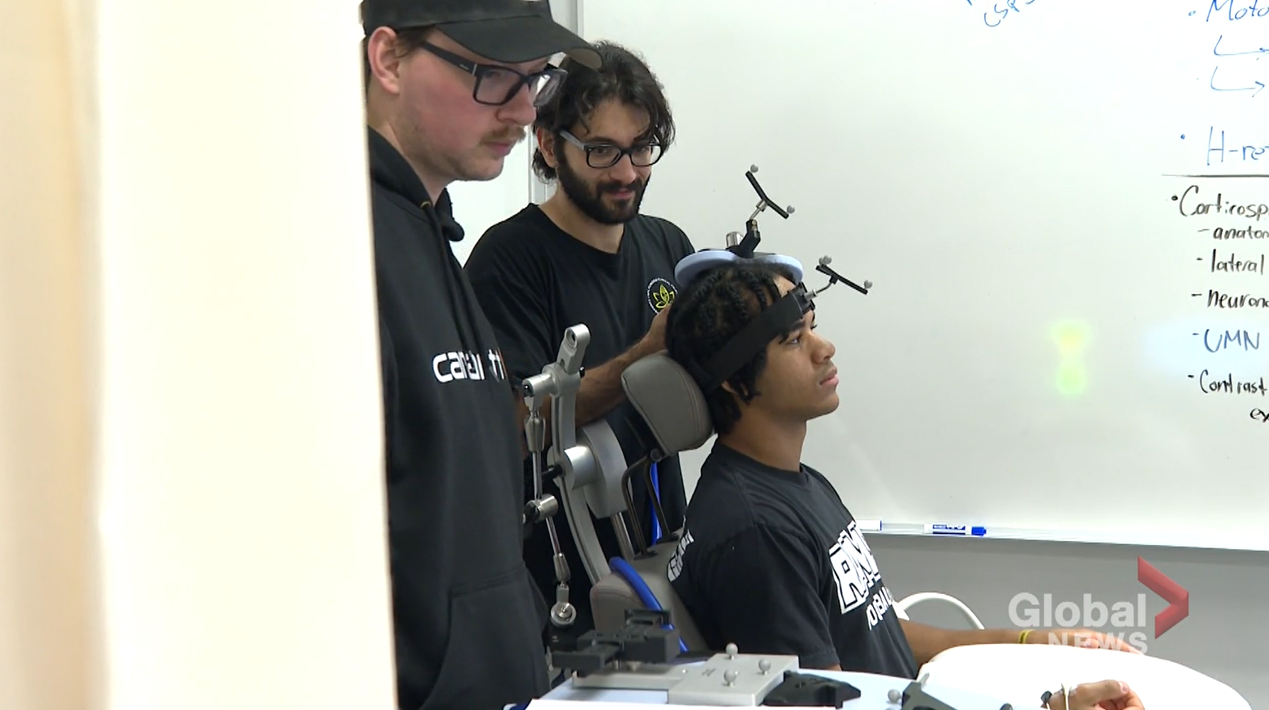 University of Regina studies new concussion treatment option: CBD