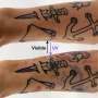 Light-responsive inks could make tattoos visible on demand, but safety remains unproven