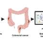Tracking molecular malfunctions in metastatic colorectal cancer to find new avenues for treatment
