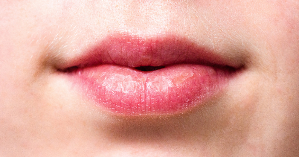 S'porean woman, 49, forcefully kisses 2 brothers, then 16 & 23 while drunk, gets 21 weeks' jail