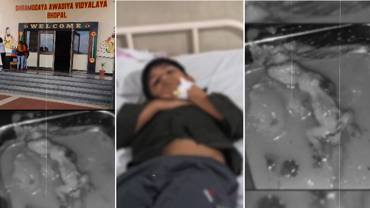 Viral VIDEO Shows Dead Lizard In Food Served At Government School Hostel In Bhopal, 13 Students Fall Ill; Parents Allege Negligence