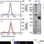 Study offers new clues about how genetic risk for Alzheimer's affects brain immune cells