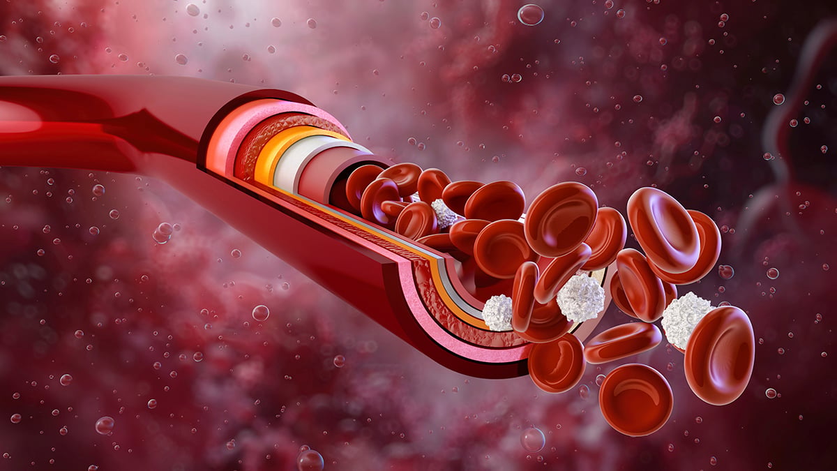 A Third Hidden Driver of High Blood Pressure Has Been Discovered – And a Potential Fix