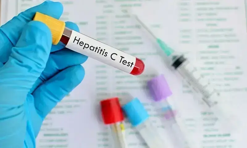 Akbar Niazi Teaching Hospital joins hepatitis screening network