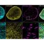 3D brain tissue model recreates key Alzheimer's interactions for drug testing