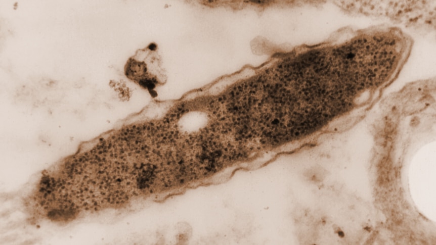 50 years on, Legionnaire's disease cases are rising in Australia