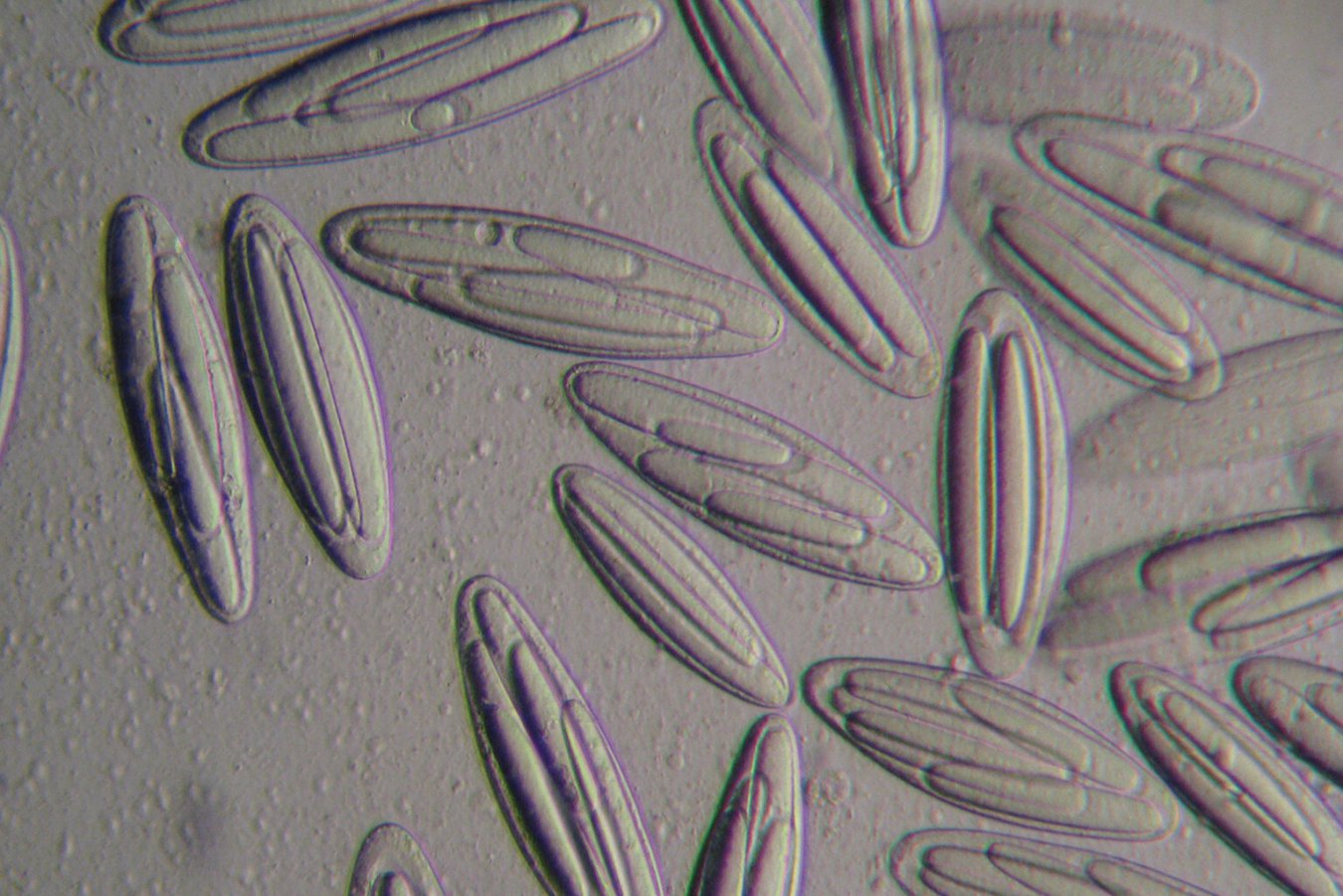 Giant bacteria could be living in your gut