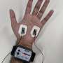 Skin measurements show link between insomnia and disrupted fear responses