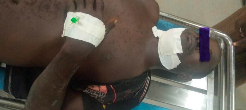 Seven arrested over Damankungyili–Nyeshie clashes which left one dead