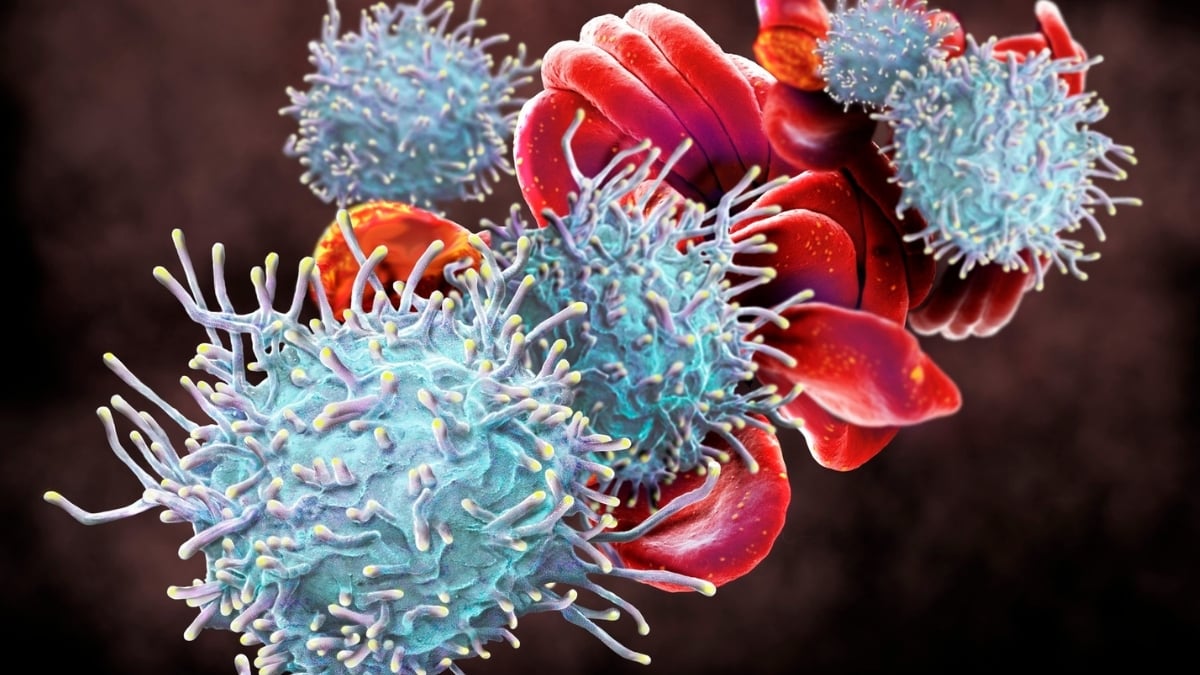 Doctors Found 4 Autoimmune Diseases in One Woman at One Time
