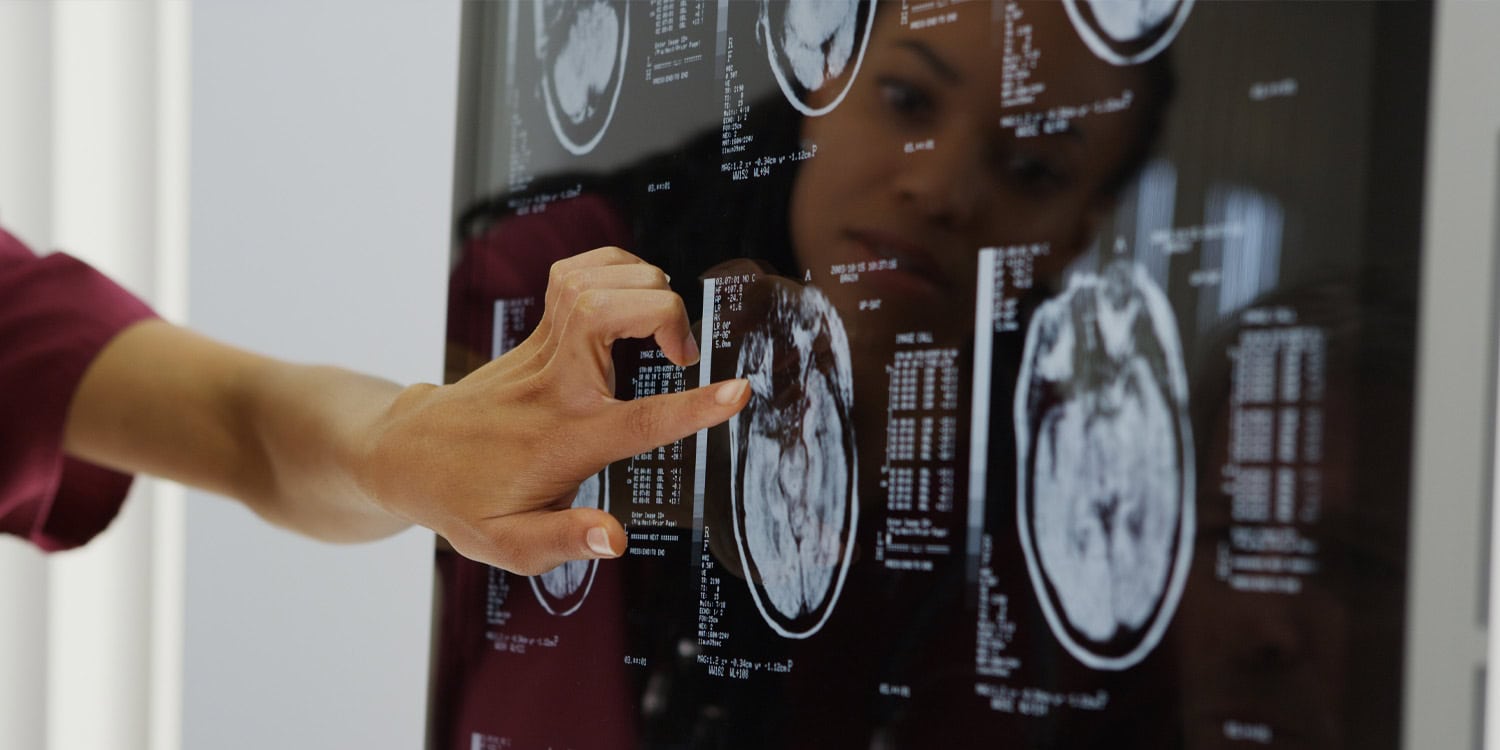 Brain scans reveal two distinct biological profiles of migraine