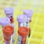 There are new blood tests for Alzheimer's. Should I have one?