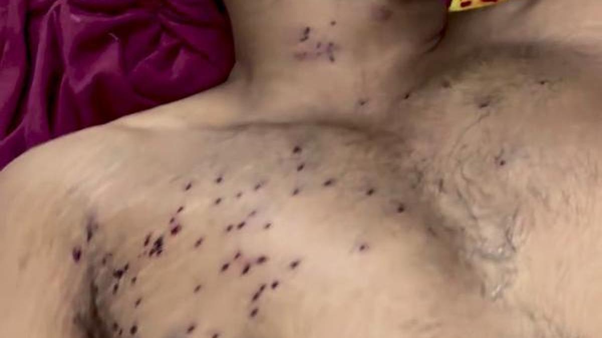 Are pellet guns legal for crowd control in India? | Explained