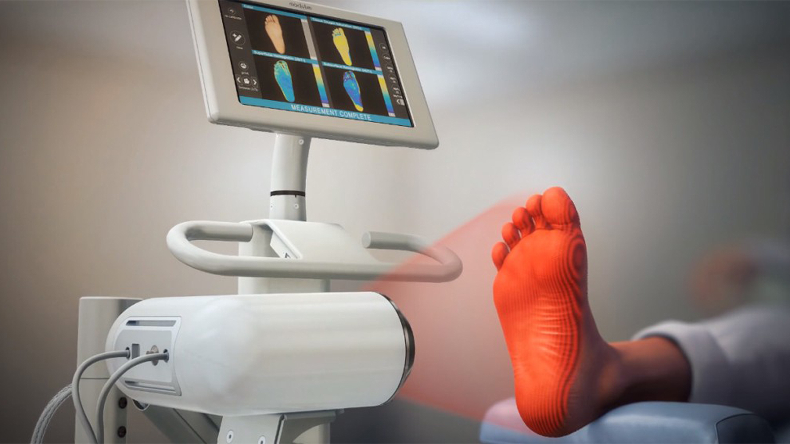 Novel Imaging Method for Skin Disease Passes Early Scleroderma Test