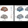 Air pollution linked to distinct brain changes in regions vulnerable to Alzheimer's disease
