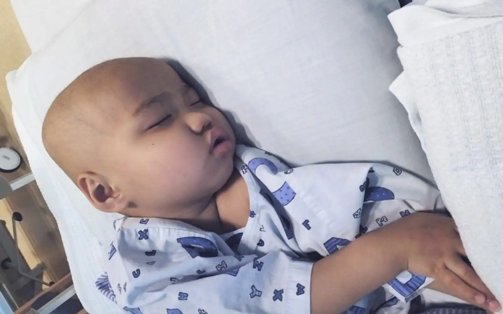 Barely 3 years old, Bazli faces 6 more rounds of chemotherapy