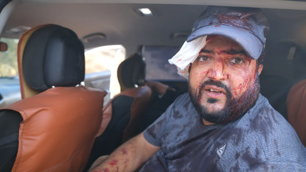 Palestinians and US journalist injured by Israeli settlers in West Bank harvest attack