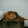 Napping linked to dementia risk