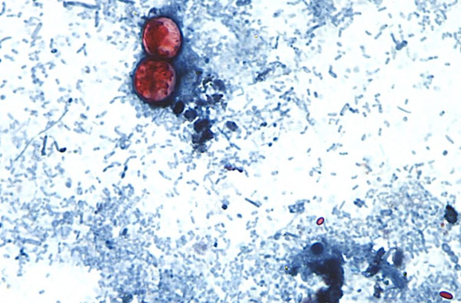 Cyclospora outbreaks with no confirmed sources grow: FDA
