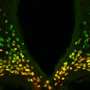 From brain wiring to stress and metabolism, one 'mastermind' gene has a finger on the switch