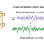 Implantable device may help restore function after spinal cord injury
