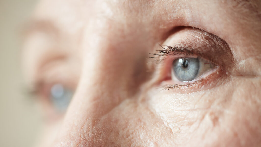 STAT+: Eyepoint study results for vision treatment disappoint, but company still sees promise
