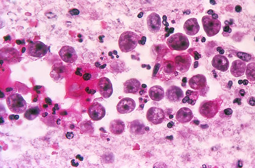 The deadly brain-eating amoeba that killed a Mérida man has now been detected in 6 artificial lakes