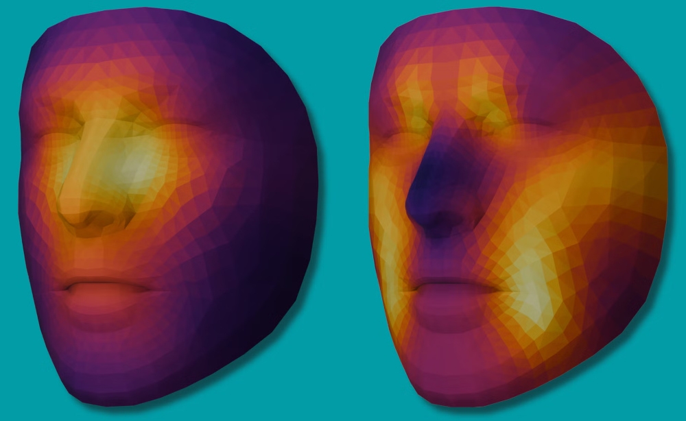 AI tool predicts cancer patients’ survival chances from facial photos, study finds