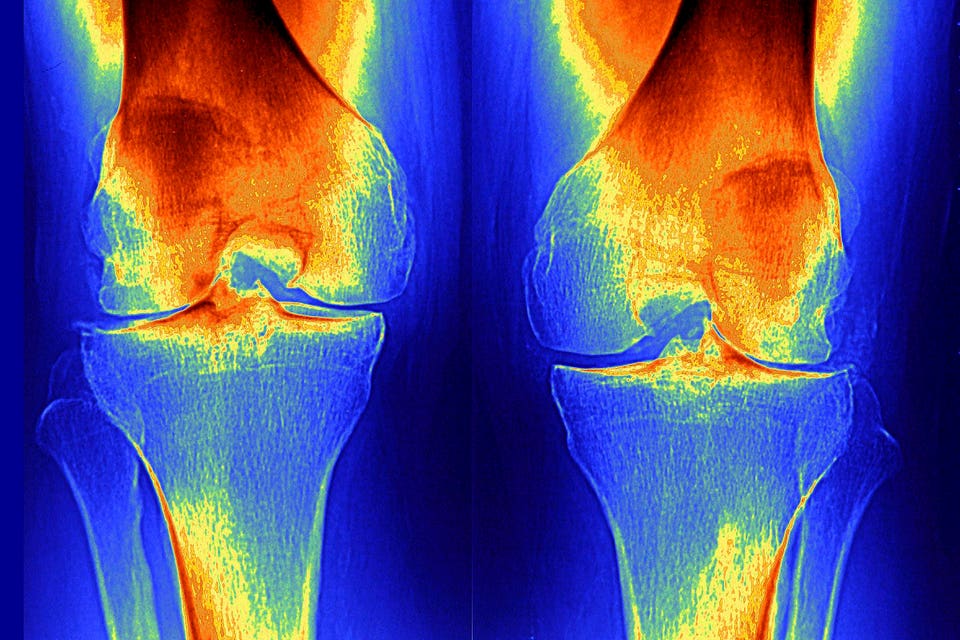Like A ‘GLP-1’ For Muscles And Cartilage?