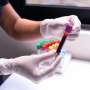 Daily blood tests flag potential to stop sepsis antibiotics nearly two days early