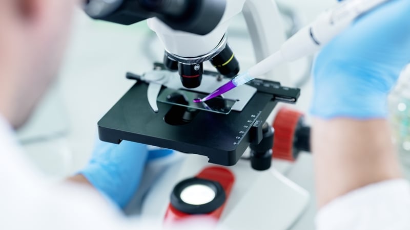 France reports first death of human from Shamonda virus