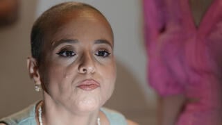 AI analyzes a single photo to predict cancer patients' risk of death