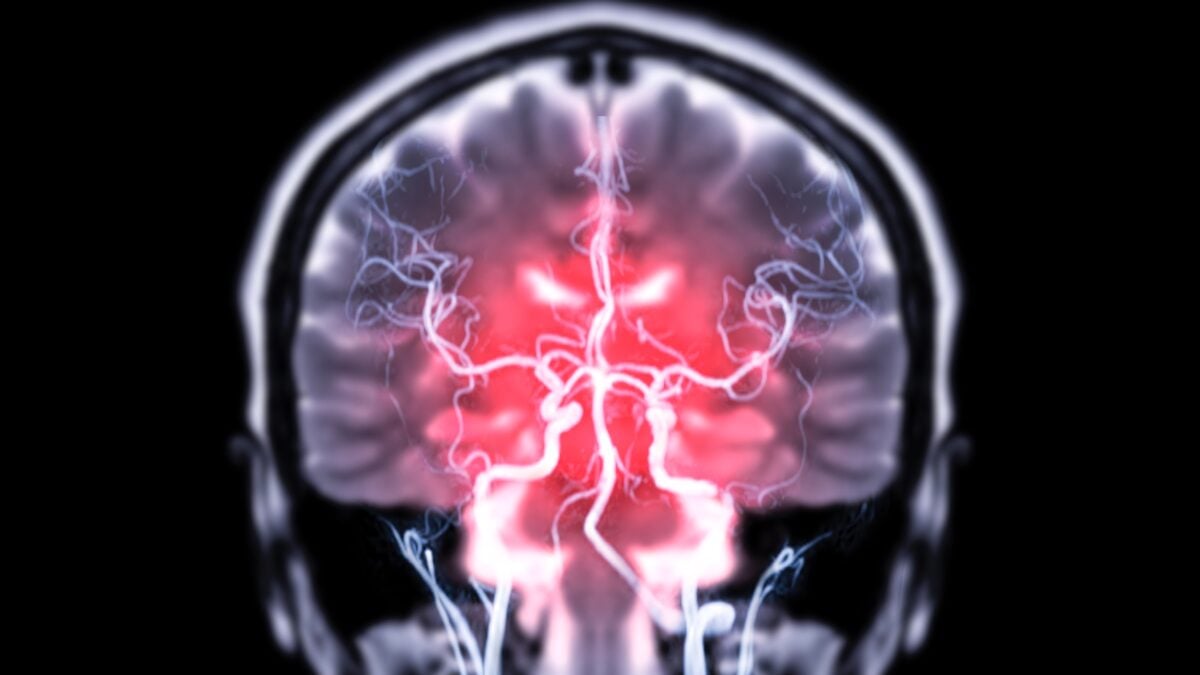 The 'Obesity Paradox' May Be a Measurement Problem, And Brain Scans Suggest Why