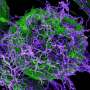 10 years after Ebola in West Africa: Laboratory partnership improves viral hemorrhagic fever diagnostics in Guinea